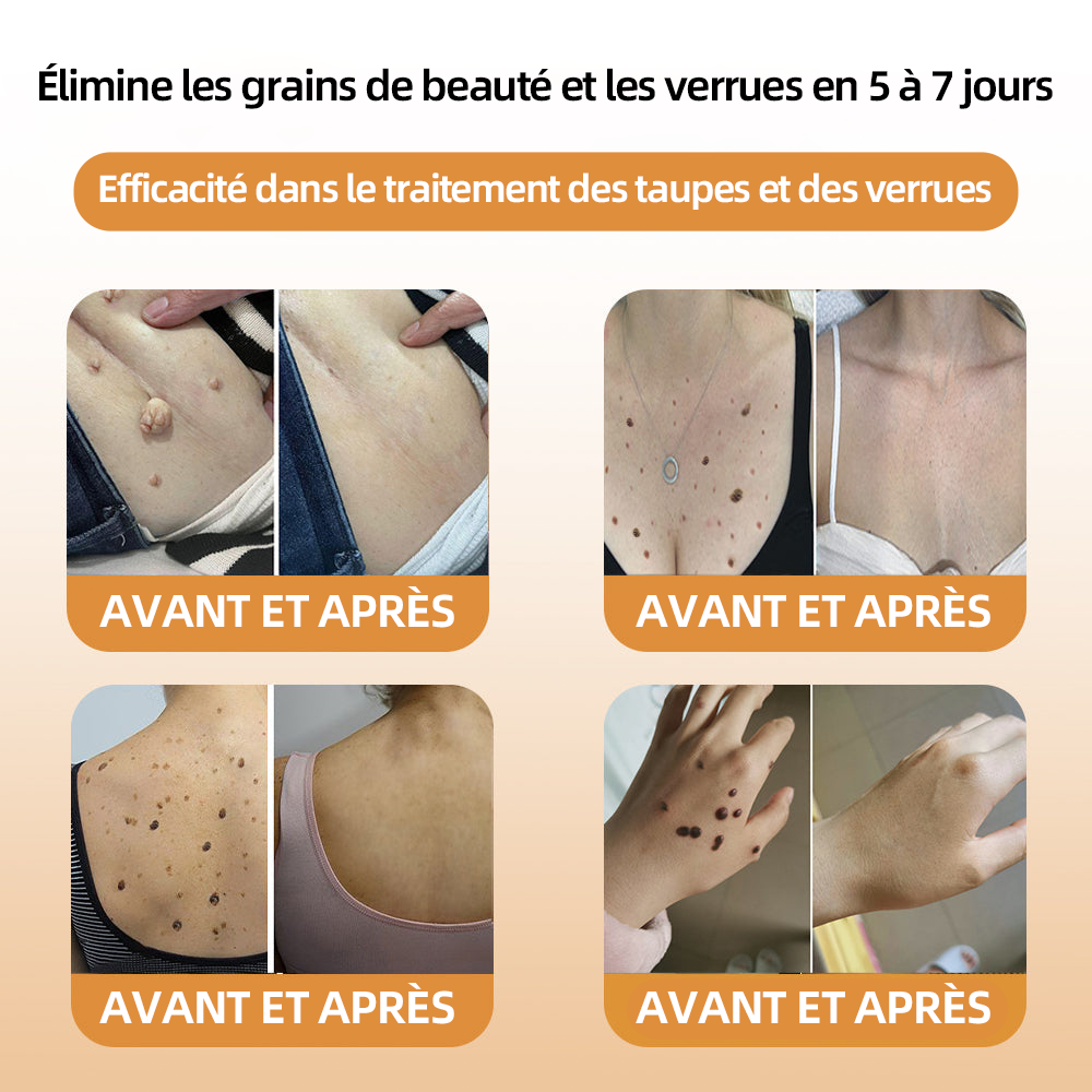 Bénéficiez de 50% de réduction pour l'ajout d'un deuxième !