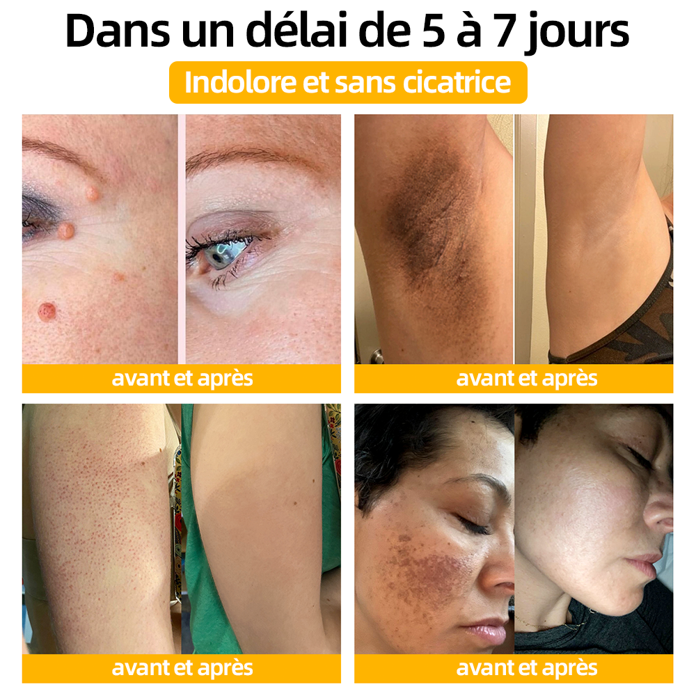 Bénéficiez de 50% de réduction pour l'ajout d'un deuxième !