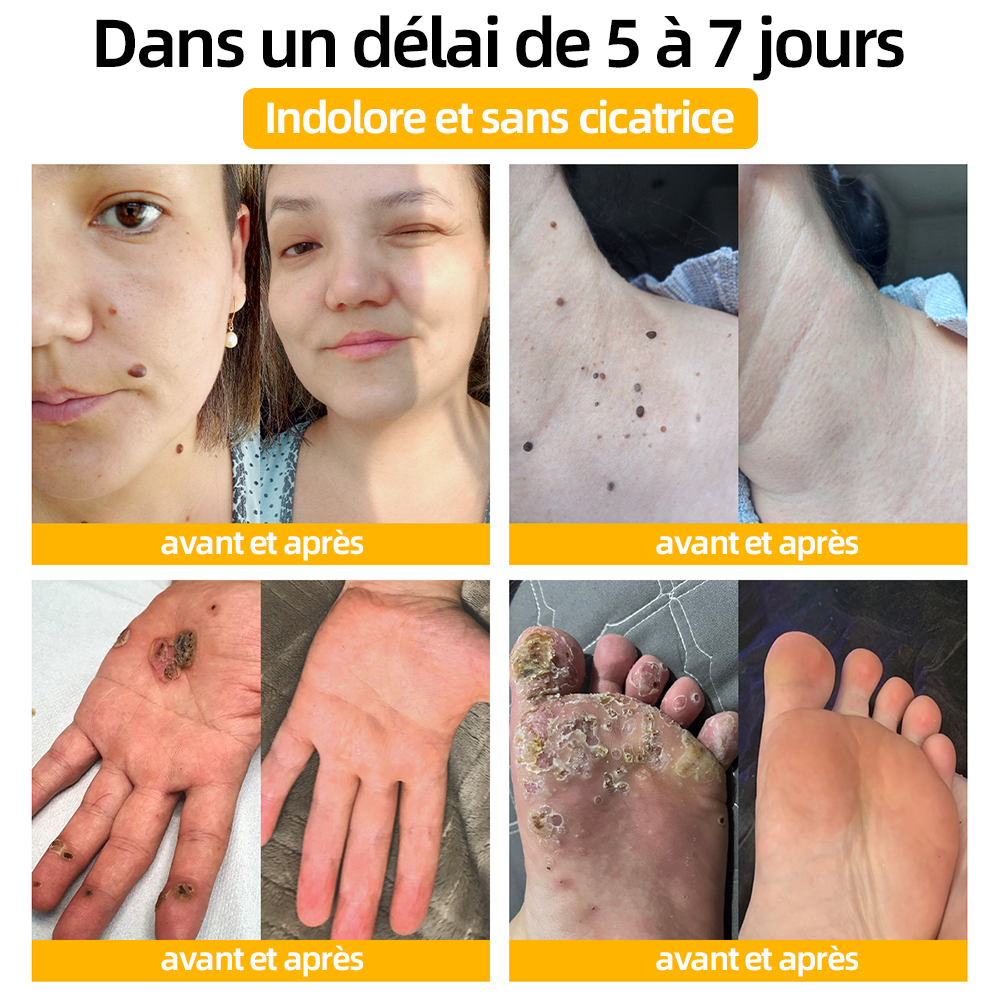 Bénéficiez de 50% de réduction pour l'ajout d'un deuxième !