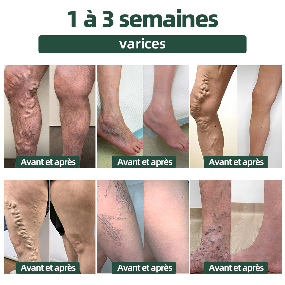 Thonesr™ perles de bain détox lymphatique pour perdre du poids (👑 Dernières 30 minutes : 40 % de réduction 👑)